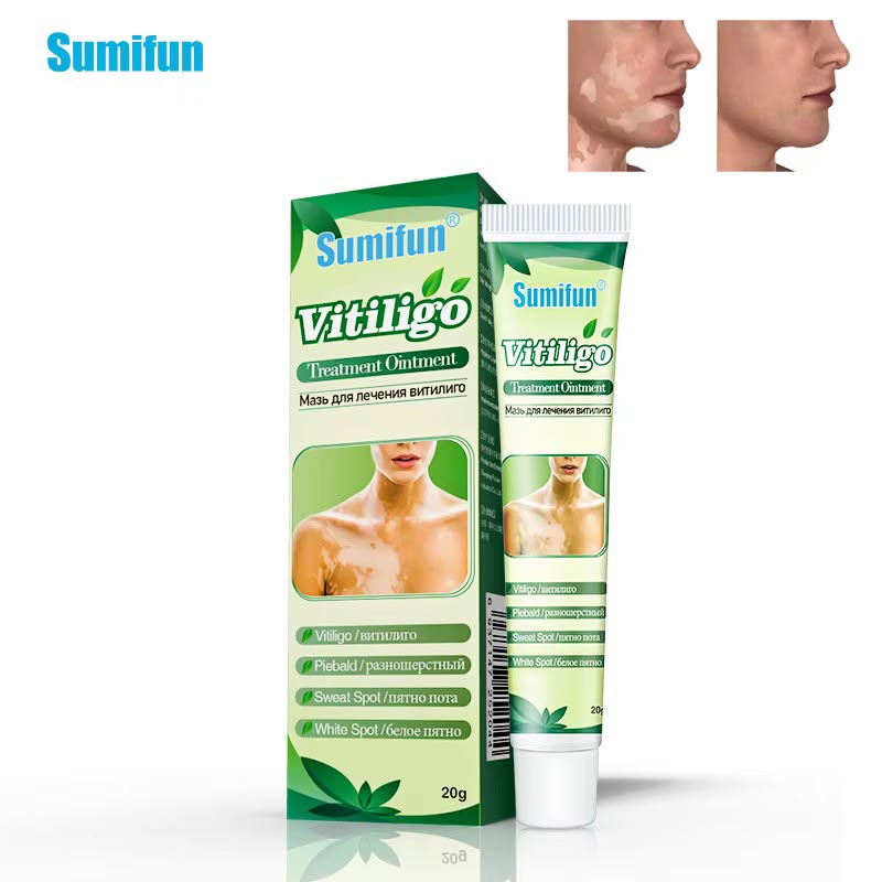 Sumifun Vitiligo Cream